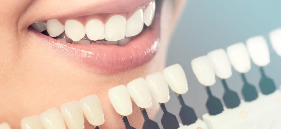 top 6 important benefits of cosmetic dentistry