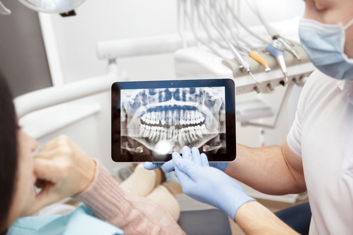 Digital vs. Traditional X-Rays: A Comprehensive Comparison